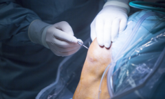 Orthopaedics